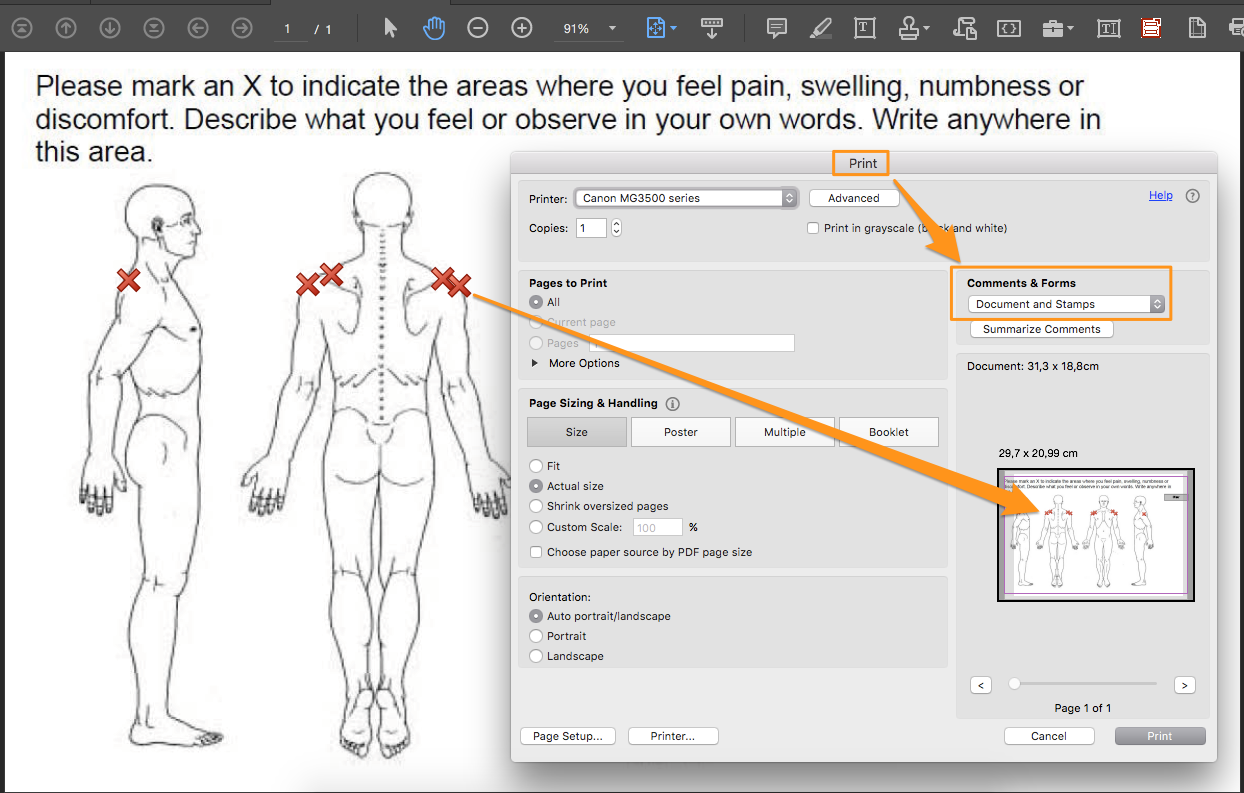 solved-indicate-pain-areas-on-body-chart-adobe-community-11104870